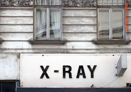 xray_0643